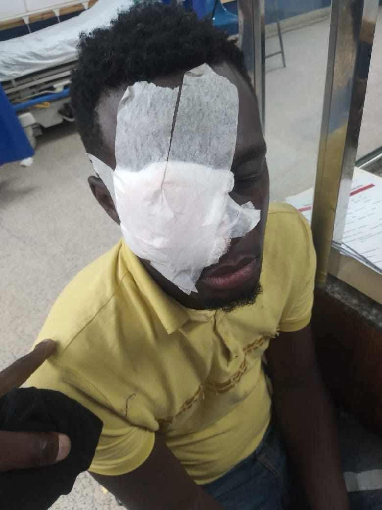 Linden man hospitalised from shot in eye