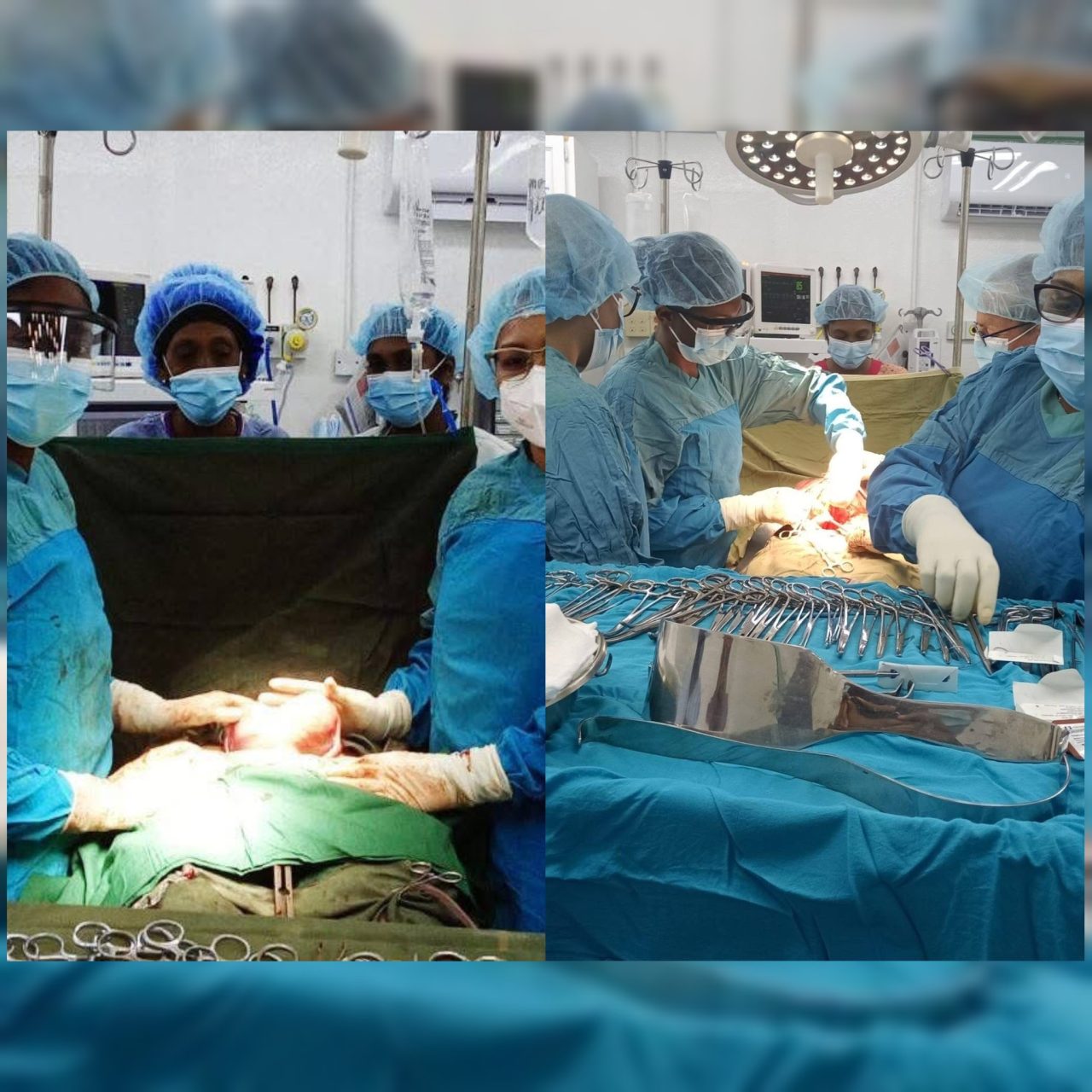 Suddie Hospital Records Over 400 Surgeries in First Half of 2025
